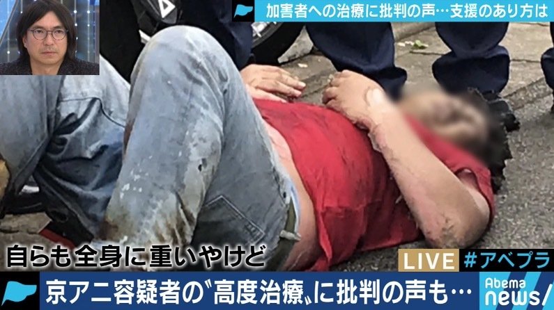 放火癖のテスト