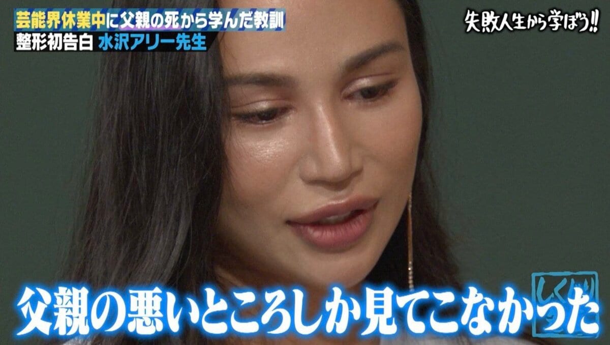 水沢 アリー 整形 前