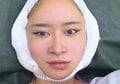 整形総額1000万円の23歳美女「上から下まで全部」衝撃の整形遍歴を告白「3週間前に顔を剥がしてあげました」