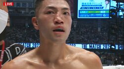 【画像】“ぐにゃり”と曲がってしまった鼻