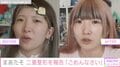 人気YouTuberまあたそ、二重整形を涙ながらに報告しビフォーアフター公開「本当にごめんなさい」