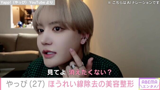 【写真・画像】“美容整形に1000万円以上”YouTuber・やっぴ、ほうれい線除去の施術後の姿に満足 過去には整形依存症も告白　1枚目