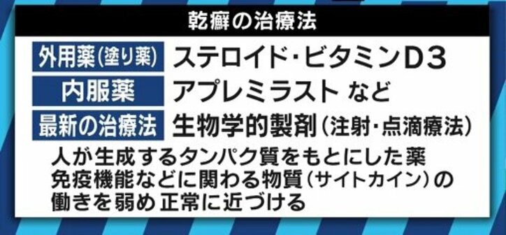 患者が告白「結婚は難しいと言われショックを受けた」 道端アンジェリカも誤解と偏見に苦しむ「乾癬」とは