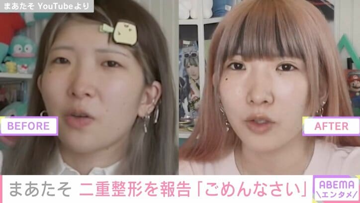 人気YouTuberまあたそ、二重整形を涙ながらに報告しビフォーアフター公開「本当にごめんなさい」