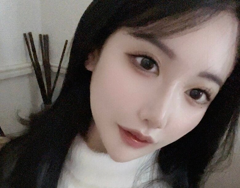 「中華美人に憧れて」整形総額1300万円の美女、今後受けたい手術を明かす