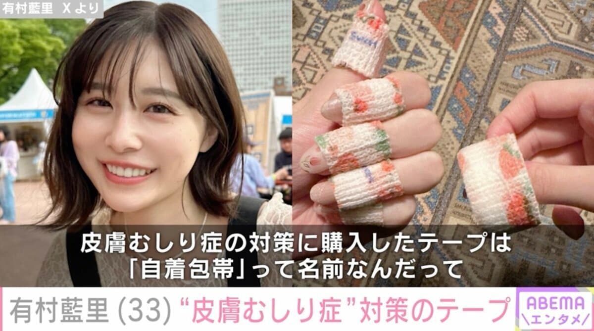 皮膚 むしり 症