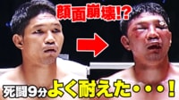 【映像】顔面崩壊…驚きのビフォーアフター
