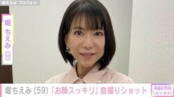 “施術後の姿”が話題・堀ちえみ「お顔スッキリ」自撮りショットを公開