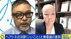 「当事者が辛いのは髪の毛がないことそれ自体だけではない」「ヘアドネーションだけでは解決しない」…善意と協力の本質を考えて