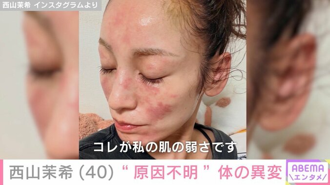 西山茉希