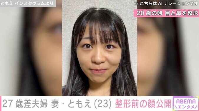 【写真・画像】27歳差夫婦“ともえとみっちゃん”妻・ともえ、整形前の顔を公開「前も今も可愛くてやばい」「柏木由紀感ある！」などの反響　2枚目