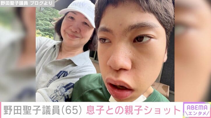 野田聖子議員 ブログより