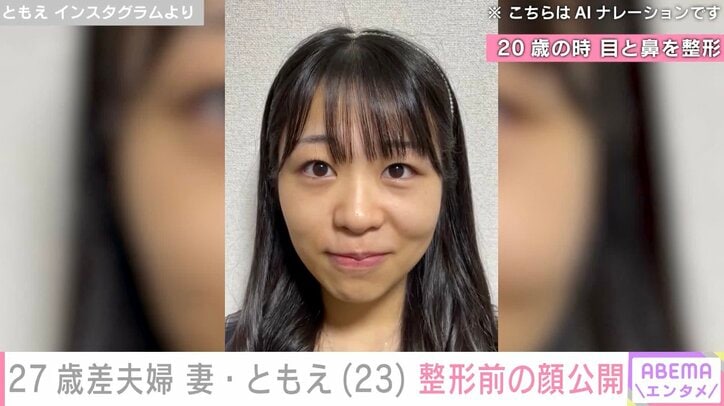 【写真・画像】27歳差夫婦“ともえとみっちゃん”妻・ともえ、整形前の顔を公開「前も今も可愛くてやばい」「柏木由紀感ある!」などの反響 2枚目