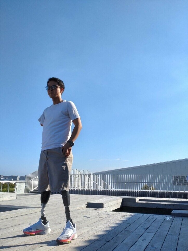 山田千紘さん、一生受給できない障害年金「右手と両足を失い、障害者になりました」 