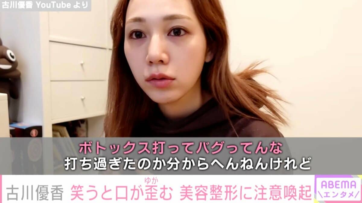 優香 ボトックスしたら顔バグった話」YouTuber古川優香、美容整形に注意喚起 歪んでしまった口元を公開 | エンタメ総合 | ABEMA TIMES |  アベマタイムズ