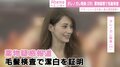 ダレノガレ明美、“薬物疑惑”受けて自ら潔白証明へ 毛髪検査を実施
