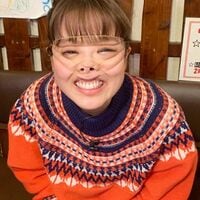 「マネはしないでください」鈴木奈々、久々の“顔面輪ゴム”姿を披露