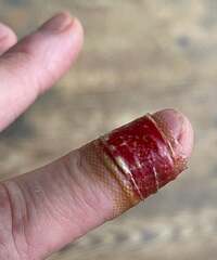 假屋崎省吾『大変、料理してたら指をザクッと包丁で切ってしまって‼️』