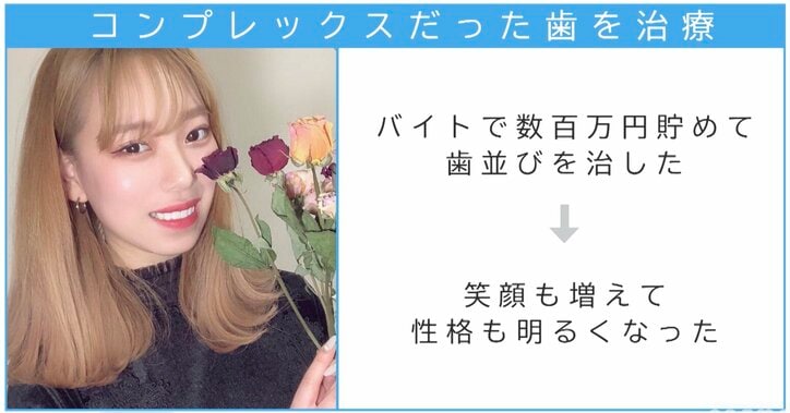 歯並びコンプレックスの小学生が、レディ・ガガに憧れ読モに…人気YouTuberタナカガ、「女ウケ抜群の垢抜け人生」を振り返る