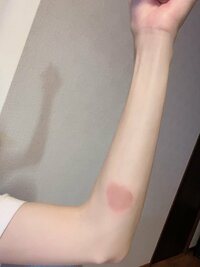 高橋真麻『痕にならなければ良いけれど…』