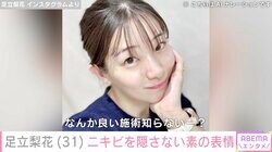 足立梨花、おでこのニキビを隠さない素の表情に反響「目立ちますね」「ニキビも可愛い」