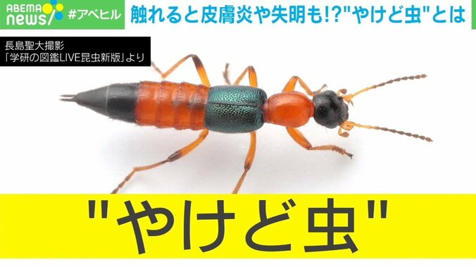 夏に活発な「やけど虫」、体液に触れると皮膚炎や失明のリスクも 身を守る方法とは 1枚目