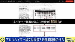 16年前の論文に捏造疑惑…世界の研究者の長年の努力は無駄に?今後の研究や創薬への影響は?『アルツハイマー征服』著者に聞く