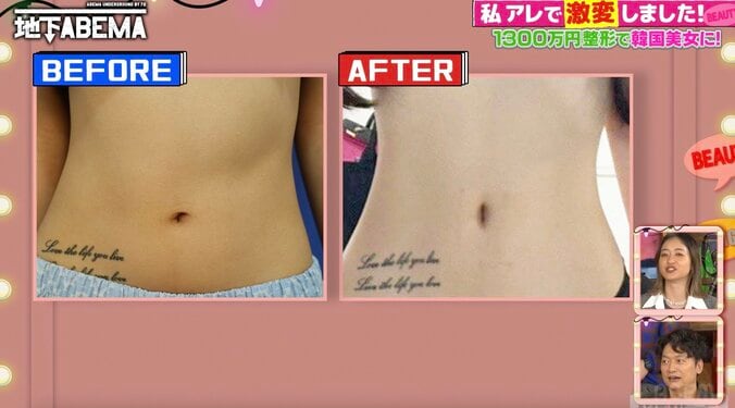 【写真・画像】整形総額1300万円の美女、“整形で縦長にした”部位に驚きの声「なんで！？」　2枚目