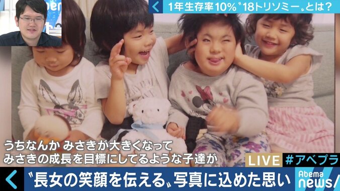 “1年以上の生存率は10％”…18トリソミー児の家族たちが写真展に託した苦悩と葛藤 6枚目