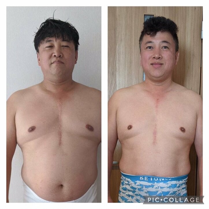痩せ