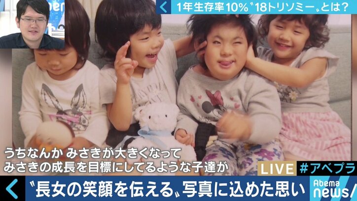 “1年以上の生存率は10％”…18トリソミー児の家族たちが写真展に託した苦悩と葛藤