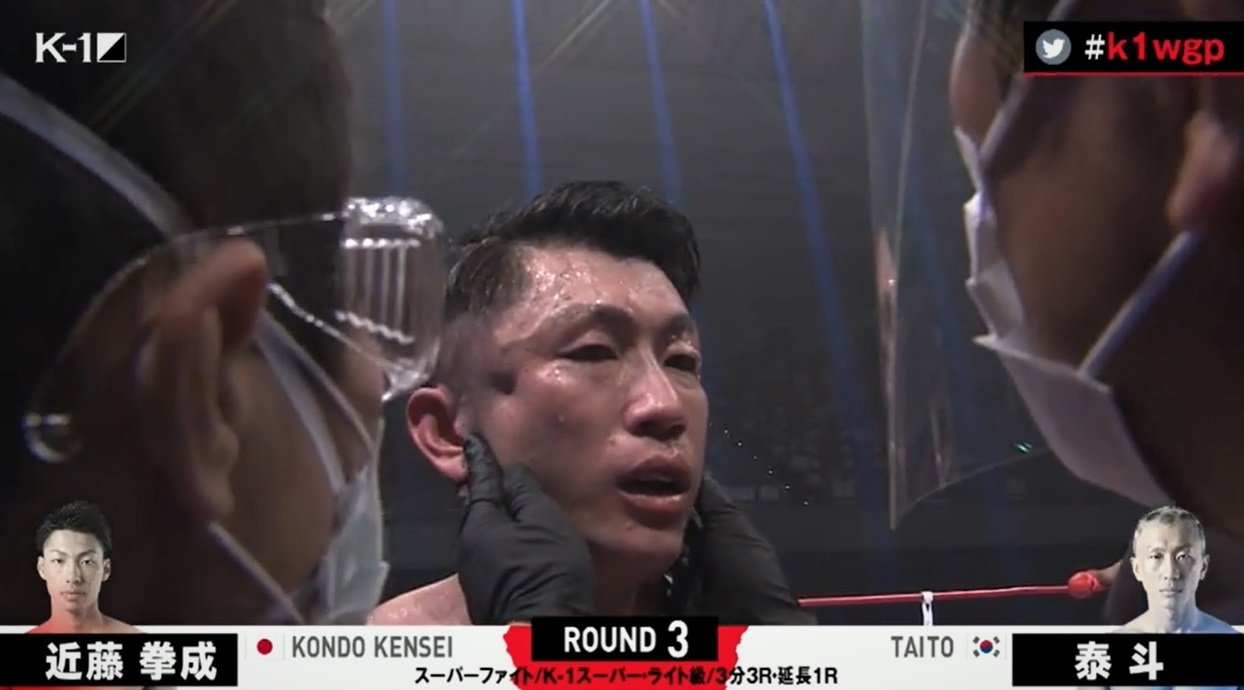 右頬骨陥没の衝撃tko決着に へこんでる 視聴者騒然 病院直行も大事には至らず ニュース Abema Times