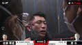 右頬骨陥没の衝撃TKO決着に「へこんでる…」視聴者騒然 病院直行も大事には至らず