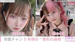 “小5で初整形・総額約1300万円”地雷チャン、5年間の整形の過程を公開「どんどんかわいくなって努力している」と反響