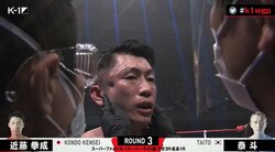 右頬骨陥没の衝撃TKO決着に「へこんでる…」視聴者騒然 病院直行も大事には至らず