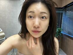  あいのり・桃、施術を受けビフォーアフターを公開「目がパッチリ開くし、トーンアップする」 