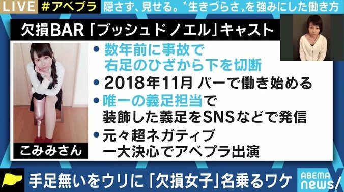 事故で右足ひざ下切断のこみみさん「何も提供してくれない第三者が『不謹慎』と言ってくる筋合いはないと思う」 障害を売りに働くことの是非 4枚目