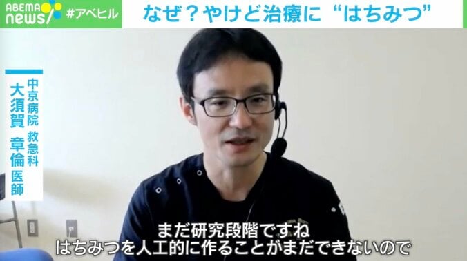 やけども回復？“はちみつ”の秘めたパワー… 医師「研究段階のため従来の方法で治療を」 3枚目