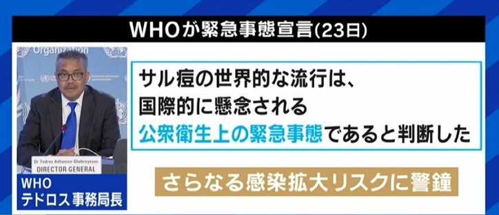 日本でも感染確認の「サル痘」、男性同性愛者への差別や偏見を生じさせない注意喚起を