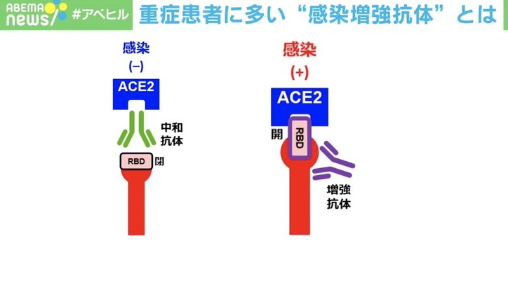 新型コロナ重症者に多い「感染増強抗体」を世界初発見 “重症化リスク”を事前に調べる手がかりに?