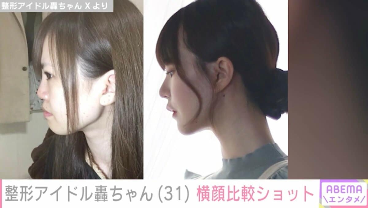 轟 ちゃん 本名
