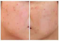  ココリコ・遠藤の妻、症状が酷くて病院を受診し気が重い検査結果「手術を受けましたが」 