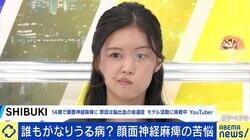 14歳で脳出血、後遺症で“顔面神経麻痺”に…「外見にこだわるタイプだった」当事者女性の葛藤 発症は原因不明の場合も？治療法は