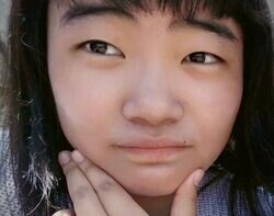 「付き合ってるのが恥ずかしい。整形しろ」美人上智大生（21歳）、整形を決意させた元カレからの“呪いの言葉”「今のままじゃ生きられないと思った」