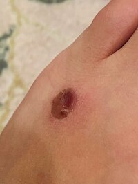 小泉貴之『【閲覧注意】身をもって痛感』