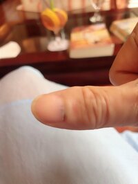 アグネス・チャン『指を挟んだ』