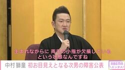 中村獅童、初お目見えとなる3歳次男の障害公表「生まれながらに、両手の小指が欠損しているという状態」