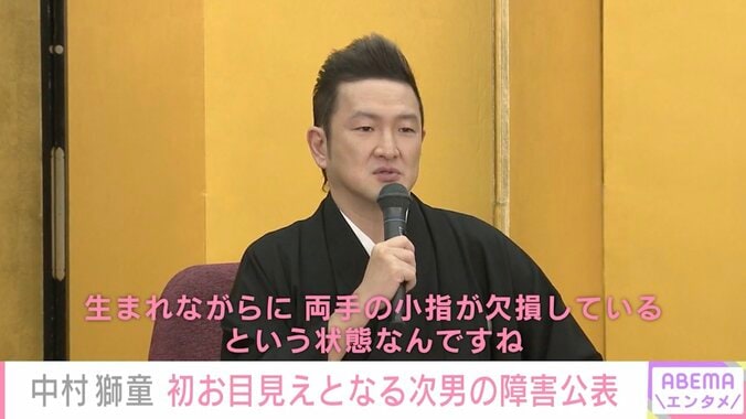 中村獅童、初お目見えとなる3歳次男の障害公表「生まれながらに、両手の小指が欠損しているという状態」 1枚目