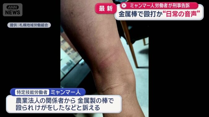 金属製の棒で頭や腕を殴られけがをしたと訴え