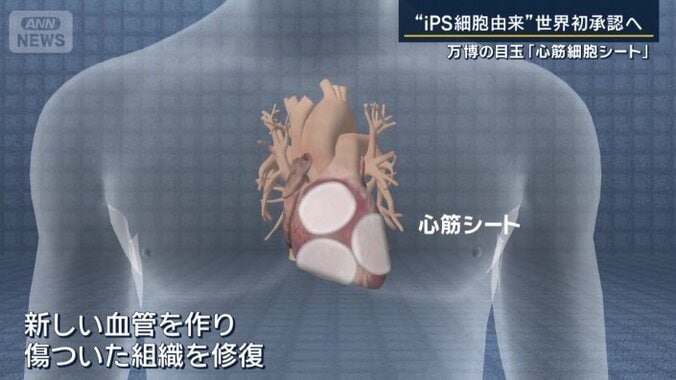 虚血性心疾患の患者